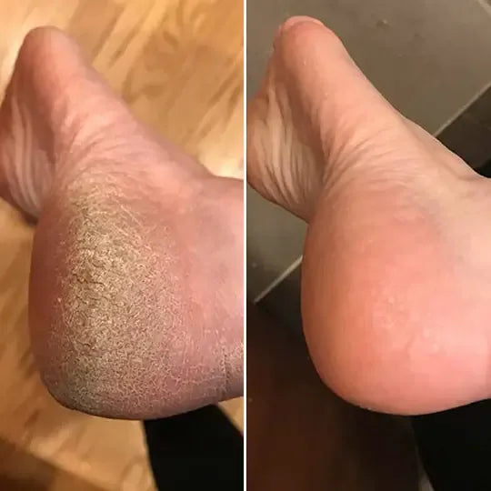 Before and after, Jennifer P.