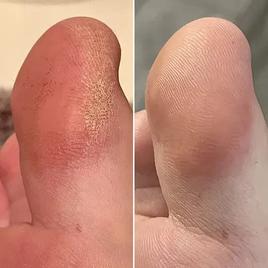 Before and after, Rina A.