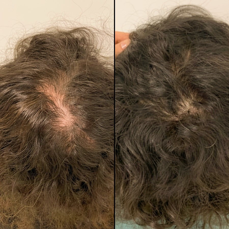 Ellaise – Stop Sudden Shedding in Weeks