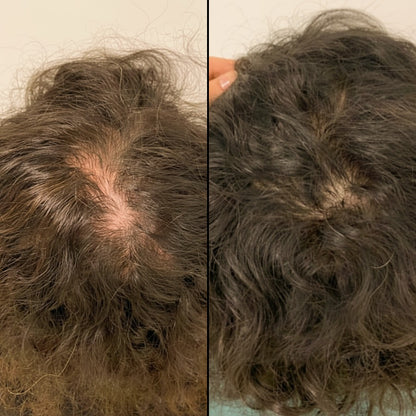 Ellaise – Stop Sudden Shedding in Weeks