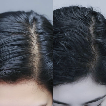 Ellaise – Stop Sudden Shedding in Weeks