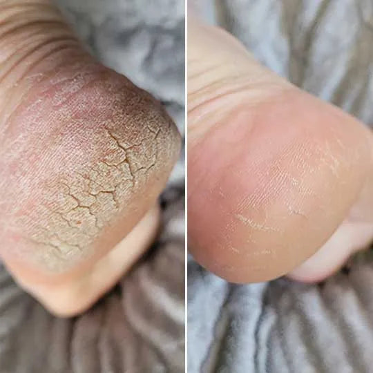 Before and after, Lara M.