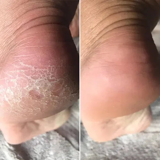 Before and after, Liz T.