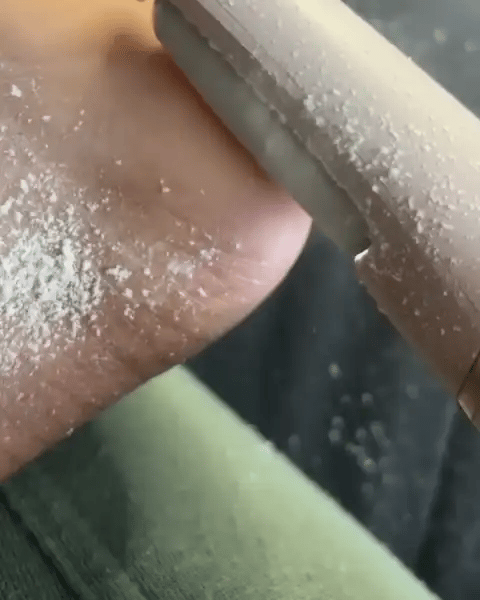 Thirty passes a second. Five minutes later the hard skin is gone.
